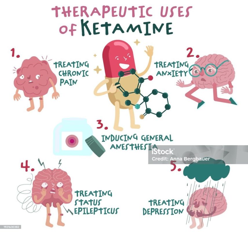 Ketamine therapy for depression
